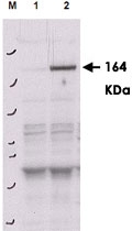 PAB11303 - ROCK2