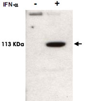 PAB11305 - STAT2