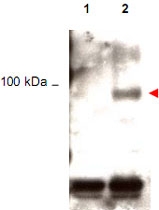 PAB11306 - STAT1