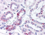 PAB11307 - STAT5 / STAT5A