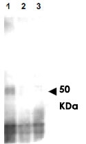 PAB11308 - MER2