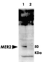 PAB11308 - MER2