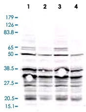 PAB11311 - RPA2