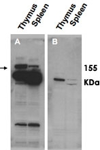 PAB11320 - POGZ