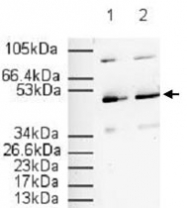 PAB11321 - PPAR-alpha
