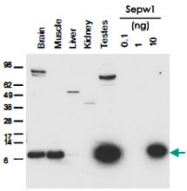 PAB11324 - Selenoprotein W (SELW)