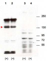 PAB11325 - SIPA1 / SPA1
