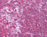 PAB11325 - SIPA1 / SPA1