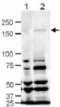 PAB11326 - SLIT1