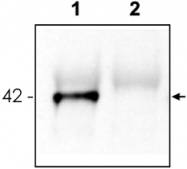 PAB11330 - GRASP