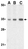 PAB11331 - TIRAP