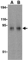PAB11333 - TLR11