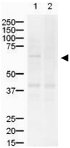 PAB11336 - ZIC2