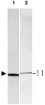 PAB11341 - S100A1