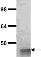 PAB11351 - Aldolase A / ALDOA