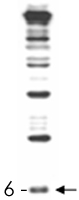 PAB11355 - RUB1