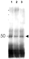 PAB11356 - MER2