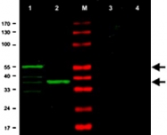 PAB11360 - CHK1