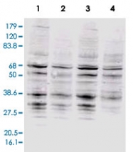 PAB11364 - RPA2