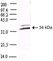 PAB11368 - SARS ORF1ab polyprotein