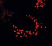 PAB11369 - SARS ORF1ab polyprotein