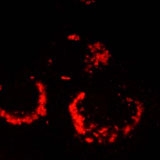 PAB11370 - SARS ORF1ab polyprotein