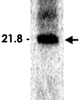 PAB11372 - SARS ORF1ab polyprotein