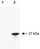 PAB11376 - RFP-Tag