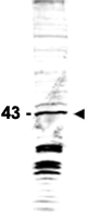 PAB11378 - swi6