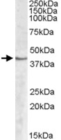 PAB11412 - Sphingosine kinase 1 (SPHK1)