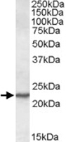 PAB11416 - SAR1A