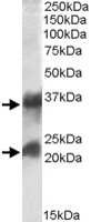 PAB11423 - Clathrin light chain A