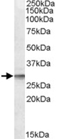 PAB11424 - DPM1