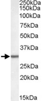 PAB11425 - DPM1