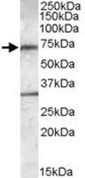 PAB11427 - LIPG