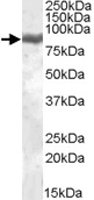 PAB11431 - Lactotransferrin