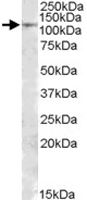 PAB11432 - MTHFD1