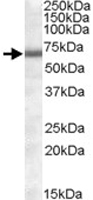 PAB11433 - COL4A3BP