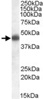 PAB11435 - Apolipoprotein L1 / APOL1