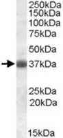 PAB11437 - Apolipoprotein J / Apo J