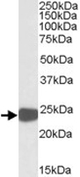 PAB11441 - Peroxiredoxin-1 / PRDX1