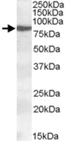 PAB11445 - ALOX15 / LOG15