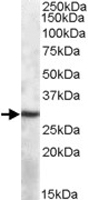 PAB11446 - APOBEC1