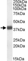 PAB11447 - Apolipoprotein L2 / APOL2