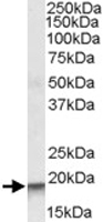 PAB11449 - ARPC4 / ARC20