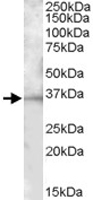 PAB11450 - CD272 / BTLA