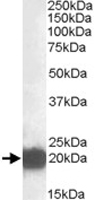PAB11452 - CSRP3