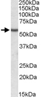 PAB11453 - Desmin