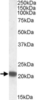 PAB11454 - Ferritin heavy chain (FTH1)