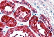 PAB11454 - Ferritin heavy chain (FTH1)